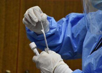 Δωρεάν rapid test για την Τετάρτη 17 Αυγούστου 2022 (Αχαΐα, Ηλεία)
