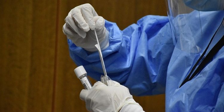 Δωρεάν rapid test για την Τετάρτη 17 Αυγούστου 2022 (Αχαΐα, Ηλεία)