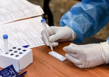 Αχαΐα: Πού θα γίνουν δωρεάν rapid tests την Τρίτη