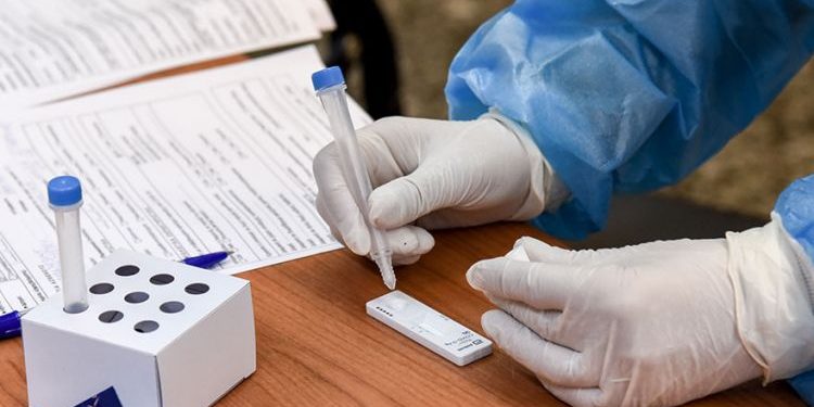 Αχαΐα: Πού θα γίνουν δωρεάν rapid tests την Τρίτη