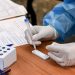 Αχαΐα: Πού θα γίνουν δωρεάν rapid tests την Τρίτη