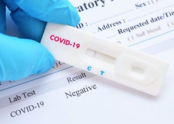 Δωρεάν rapid test σε Αχαΐα, Ηλεία και Αιτωλοακαρνανία για την Τετάρτη 5 Οκτωβρίου