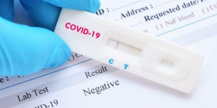 Δωρεάν rapid test σε Αχαΐα, Ηλεία και Αιτωλοακαρνανία για την Τετάρτη 5 Οκτωβρίου