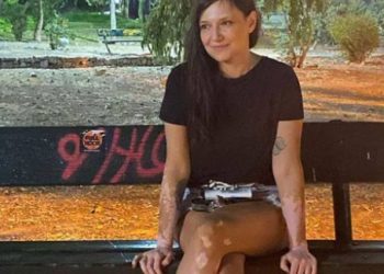 Η Αθηναΐς Νέγκα για την ανήθικη επίθεση για την πάθησή της: «Έγραψε σοκαριστικές κακοήθειες»