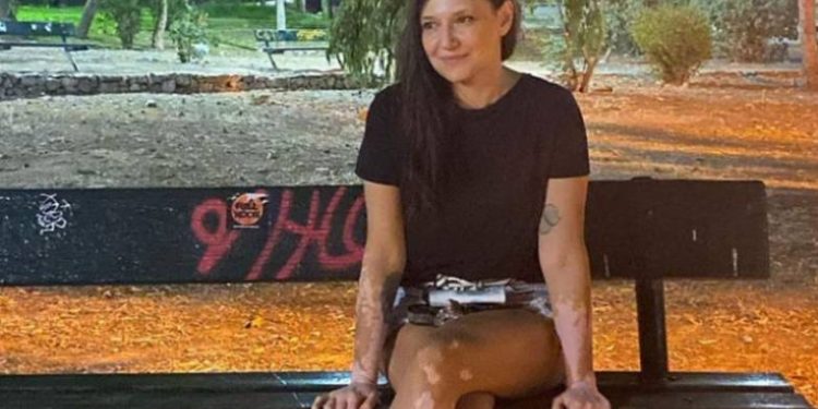 Η Αθηναΐς Νέγκα για την ανήθικη επίθεση για την πάθησή της: «Έγραψε σοκαριστικές κακοήθειες»