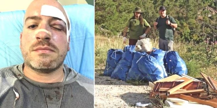 Άγρια επίθεση στην Πάρνηθα: Ξυλοκόπησαν και μαχαίρωσαν εθελοντές που καθάριζαν το δάσος