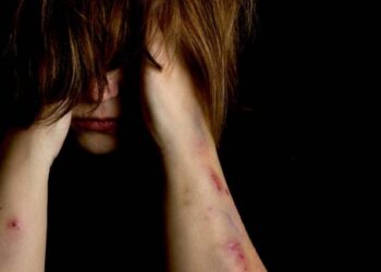 Χωρίς τέλος η φρίκη στη Μυτιλήνη: Νέα πρόσωπα στο «κάδρο» για τον βιασμό της 13χρονης – Σε κακή κατάσταση η ανήλικη