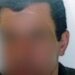 Ηλεία: Σήμερα στον εισαγγελέα ο 56χρονος που πυροβόλησε στο κεφάλι 47χρονο μετά από καυγά