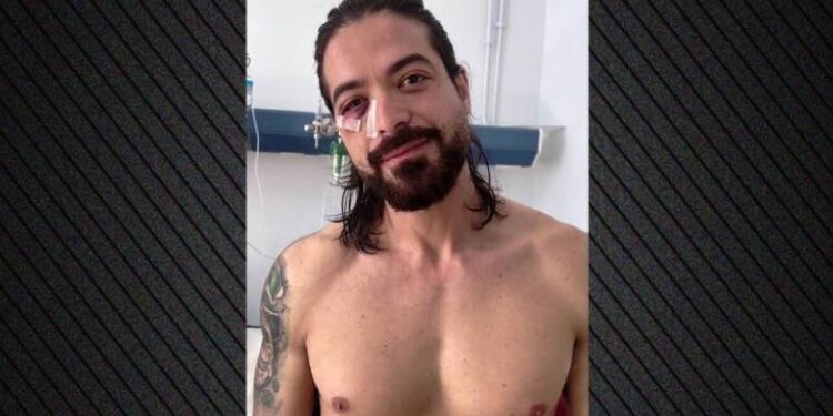 Αχαΐα: «Έχασα ό,τι πιο πολύτιμο είχα, νόμιζα ότι ήταν καπνογόνο» – Τα πρώτα λόγια του Άρη Μουγκοπέτρου από το νοσοκομείο μετά τον ακρωτηριασμό του (ΒΙΝΤΕΟ)